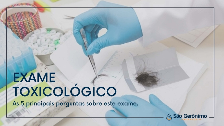 Exame toxicológico - O que preciso saber?