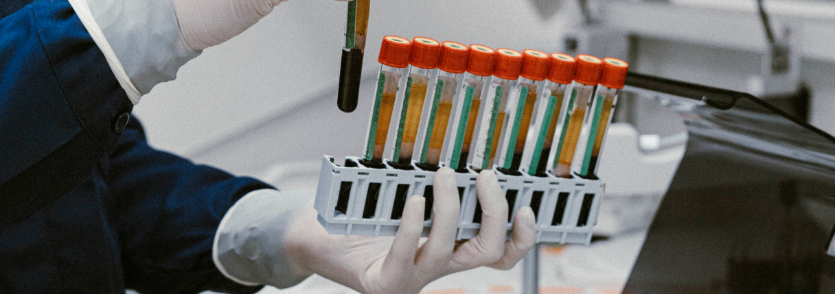 Exame de Peptídeo C: para que serve, preparo e resultados