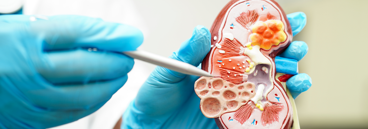 Fosfatase Alcalina: para que serve, valores e como se preparar